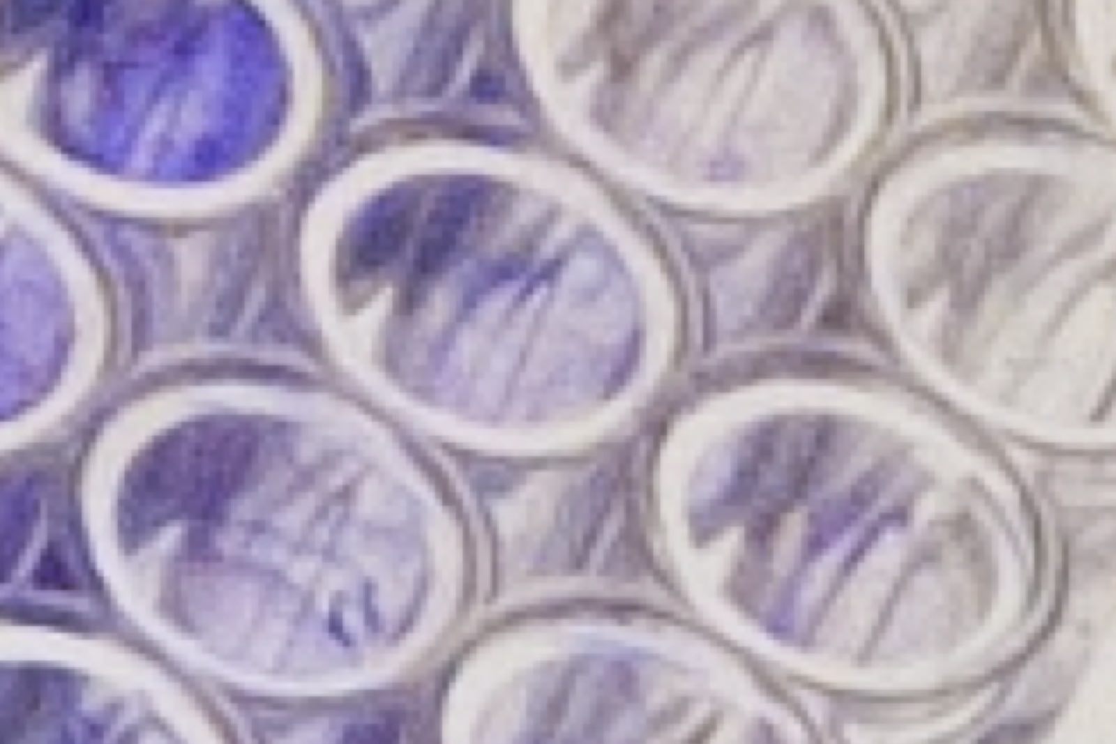 Gloved hands examining a stained 96-well assay plate over a laboratory light box