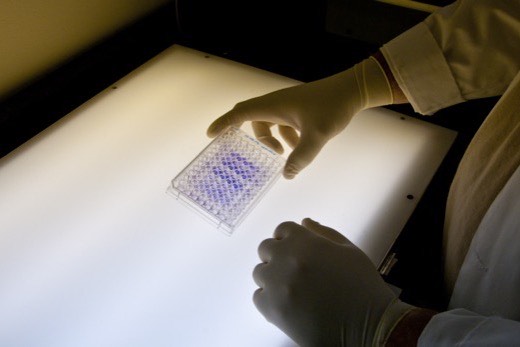 Gloved hands examining a stained 96-well assay plate over a laboratory light box